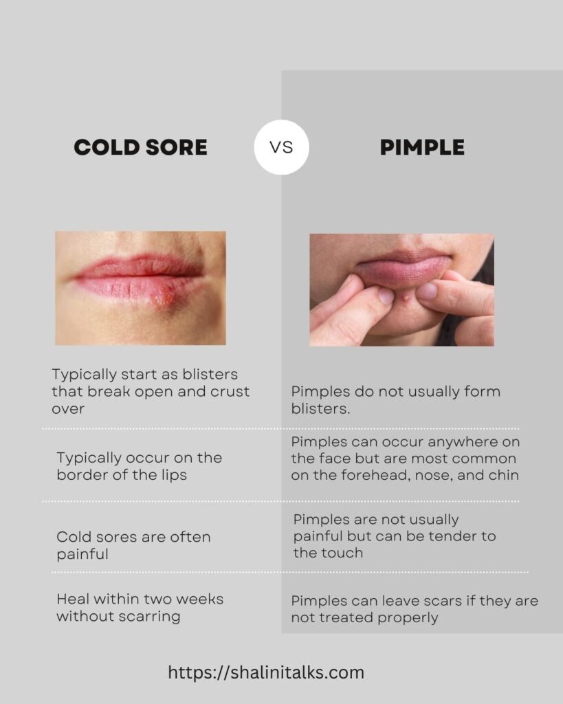 cold sore vs pimple on lips