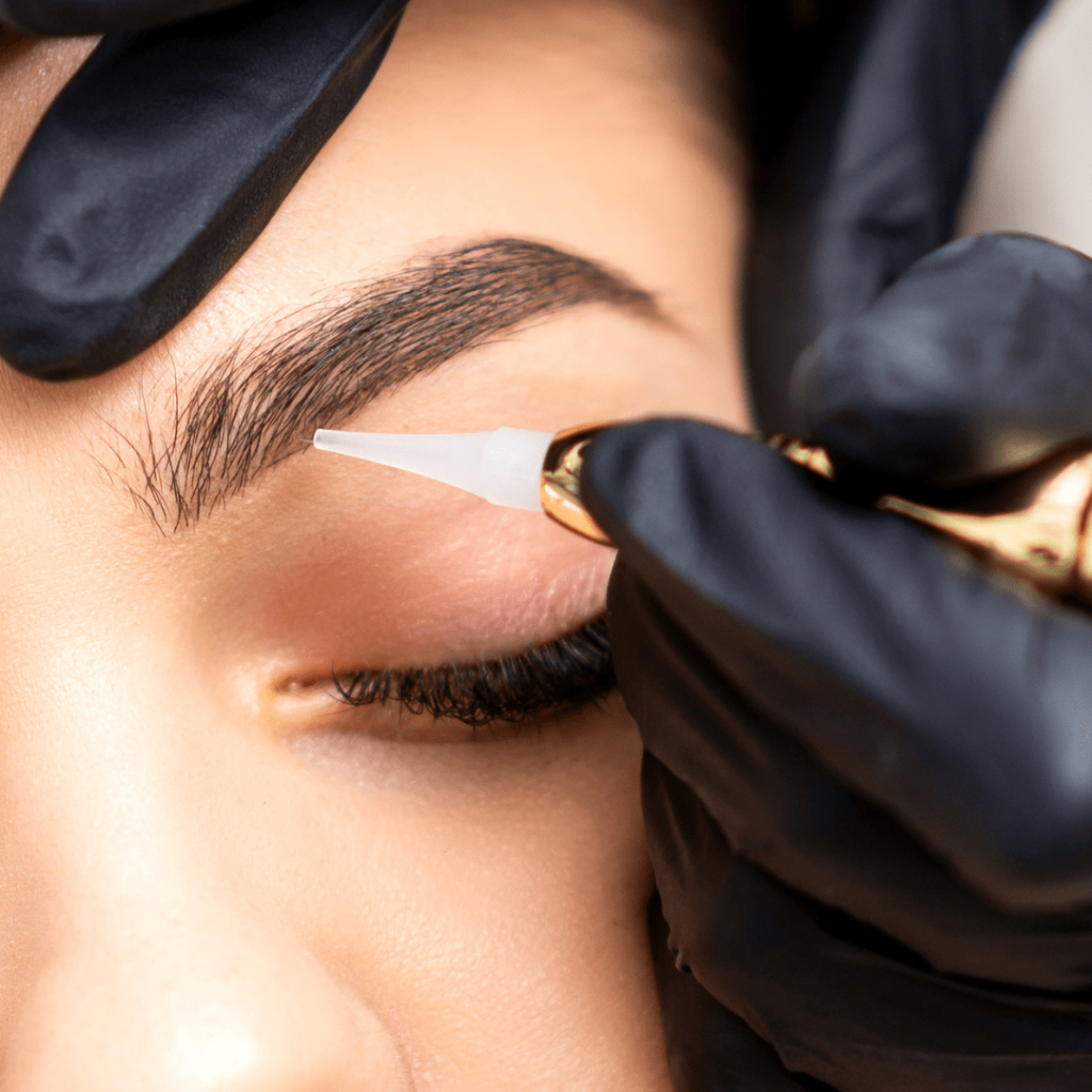 laser hair removal for eyebrows